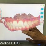 Youtube: What is a Dental Health Scan?
